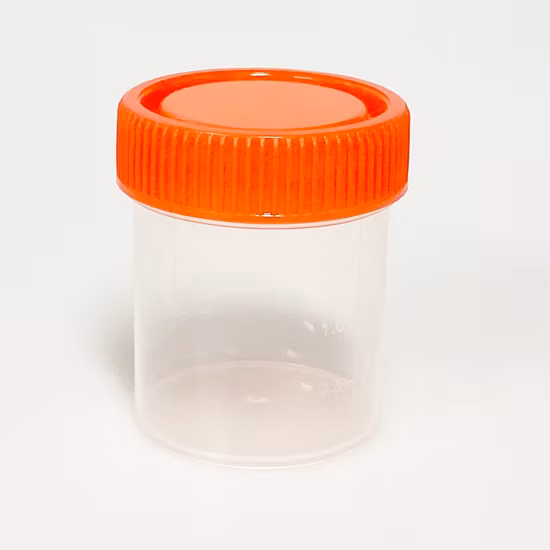 Récipient de Test de tasse de collecte d'échantillon d'urine sous vide stérile de 90ml